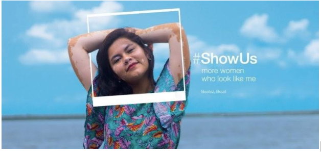 Dove: ‘#ShowUs’ campaign